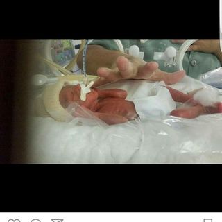 milagredeumprematuroextremo